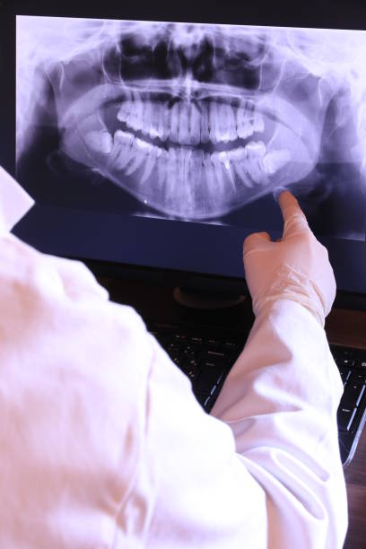 Best Emergency Dentist for Knocked-Out Tooth in Angleton, TX