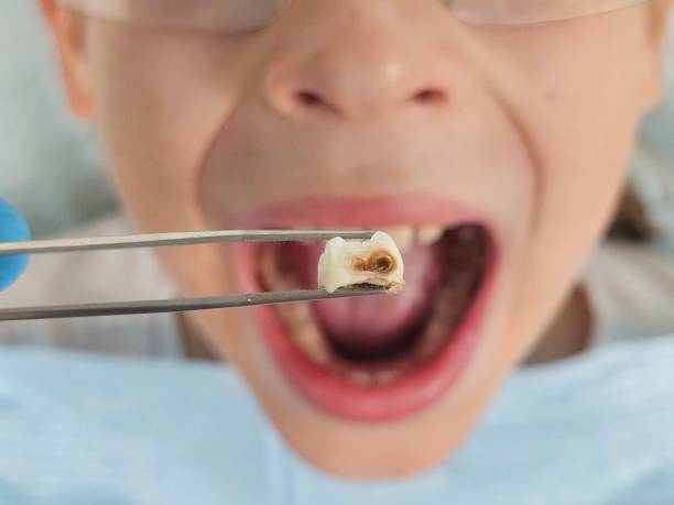 Best Orthodontic Emergency Dentist in Angleton, TX